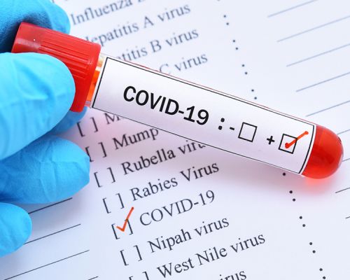 Обследование на наличие антител к COVID-19